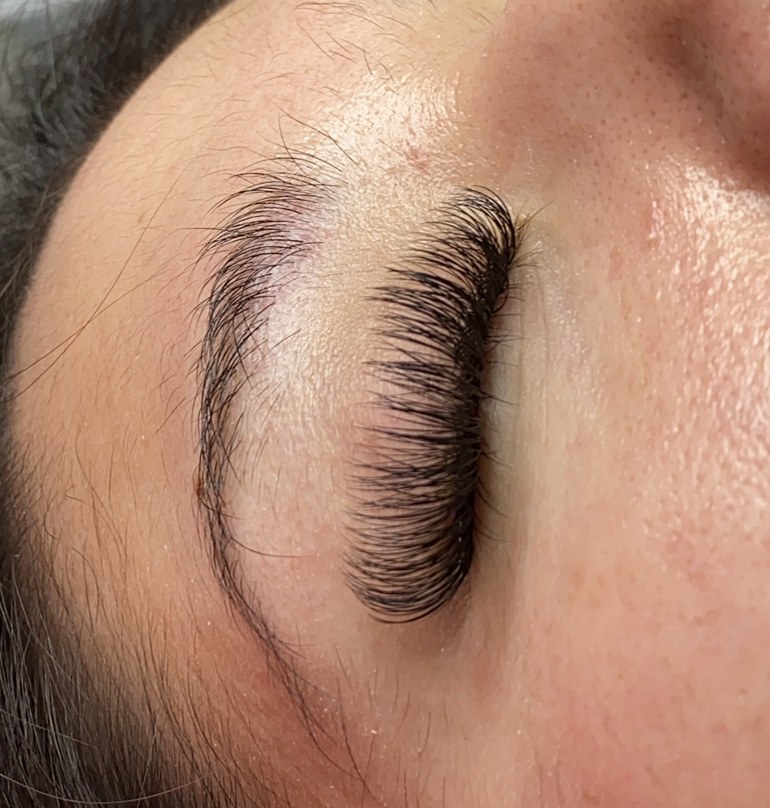 Hybrid lash set